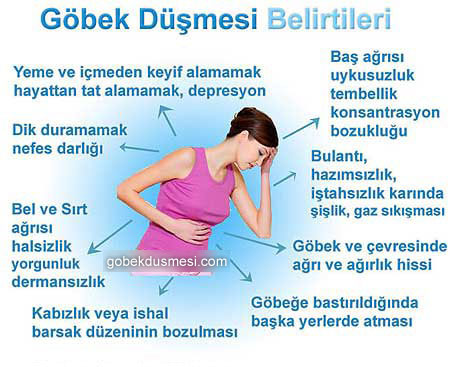 Göbek Düşmesi (kayması) belirtileri